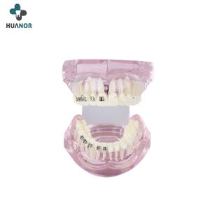 Selling Well Product Semi-Metal Semi-Ceramic Teaching Dental Teeth Model