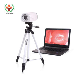 Digital Electronic Video Colposcope Colposcopy for Gynecology
