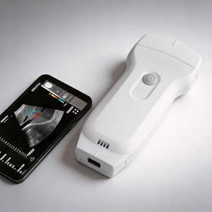 USB Wireless Ultrasound Prober or Linear Probes Scanner