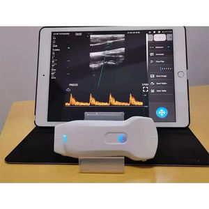 Handheld 3 in 1 Portable Ultrasound Probe
