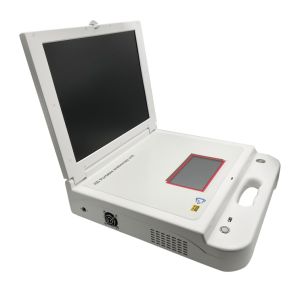 in-Gw605 Portable Hysteroscopy Video Endoscope Camera System LED Monitor Endoscope Price