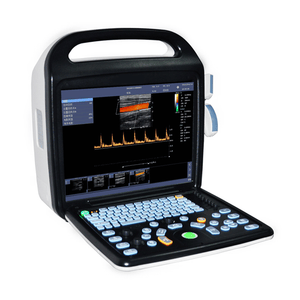 4D Portable Color Doppler Ultrasound Scanner Durable Metal Plastic and Steel Electric Power Source Ultrasound Medical Equipment