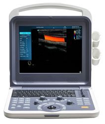 Full Digital Portable USB Ultrasound Color Doppler