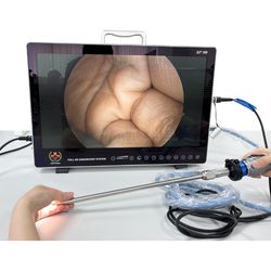 Sy-PS050 Portable 4 in 1 Hysteroscopy 1080 HD Medical Endoscope Camera