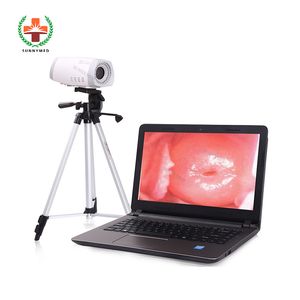 High Quality Hot Sale Women Portable Electronic Colposcope Price