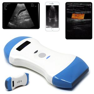 Dual Head Ultrasound Scanner 3 in 1 Convex Linear Phased Array Pocket Ultrasound
