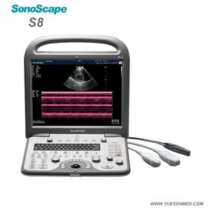 Medical Hospital S8 Portable 4D Color Doppler Ultrasound Machine