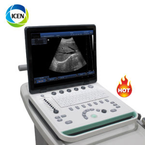 in-A032-1 Ultrasound Therapy Ultrasonic Diagnostic Full Digital Laptop Home Ultrasound Scanner Ultrasound Machine