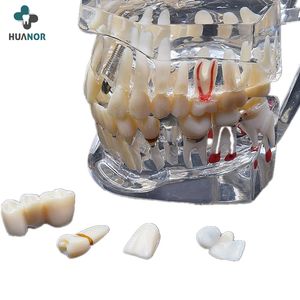 High Quality Medical Dental Anatomy Model Dental Tooth Model Study Teeth Model Standard Demonstration