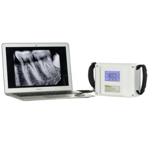 Portable Dental Wireless Intraoral Digital Dental X Ray Machine