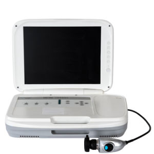 HD Portable Ear Endoscope Camera with LED Cold Light